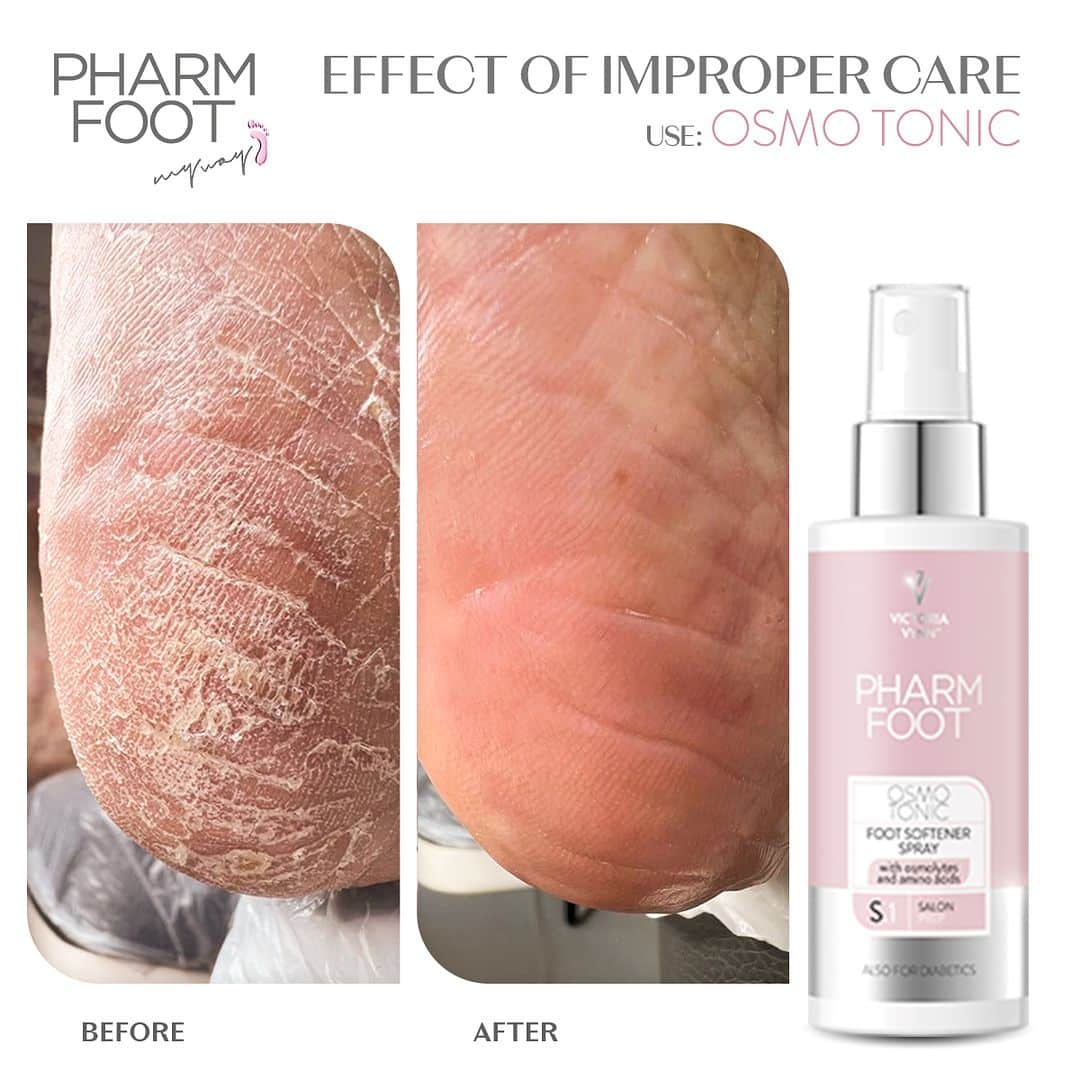 Pharm Foot | OSMO TONIC ספריי ריכוך רגליים עשיר באוסמוליטים וחומצות אמינו
